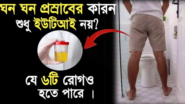 ঘনঘন প্রস্রাব হলে কোন কোন খাবার খাওয়া উচিত নয় - প্রস্রাবের সমস্যা ও সমাধান - ghono ghono prosab hole koronio.