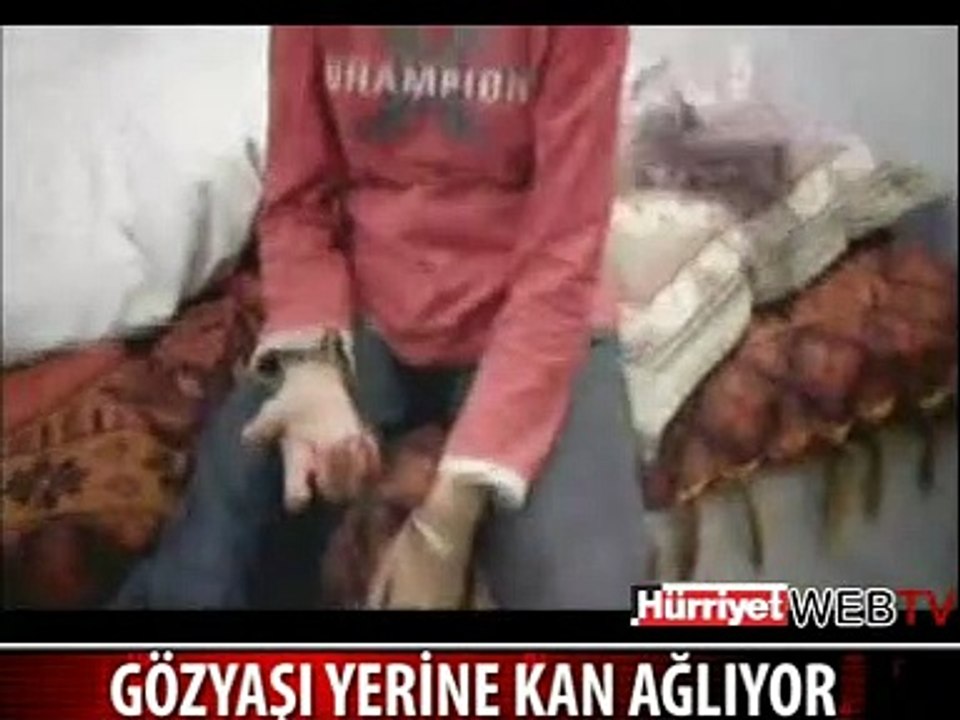 GÖZLERİNDEN KAN AĞLAYAN KIZ