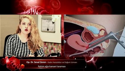 Rahim ağzı kanseri taraması