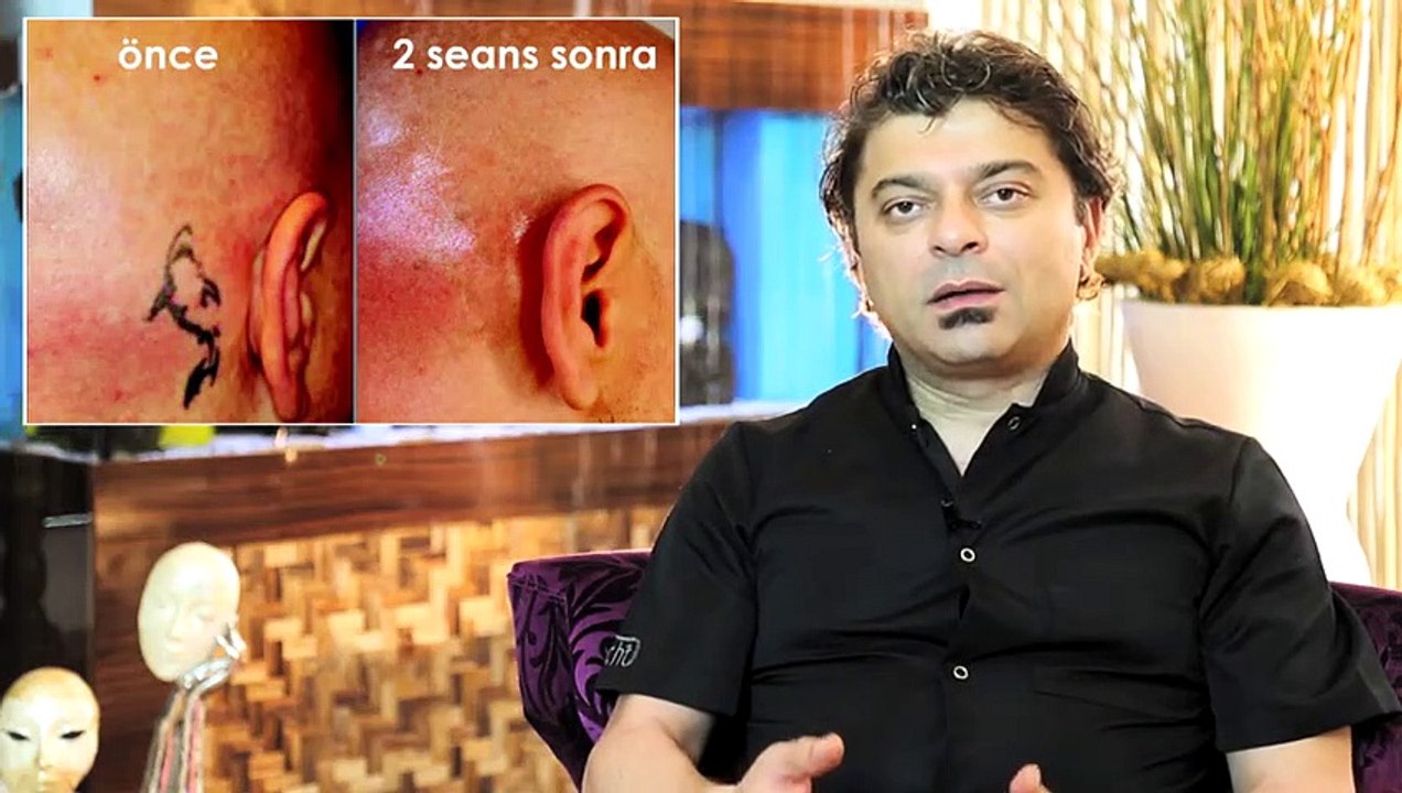Picosil (picosure) nedir?