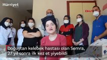 Doğuştan kelebek hastası olan Semra, 27 yıl sonra ilk kez et yiyebildi