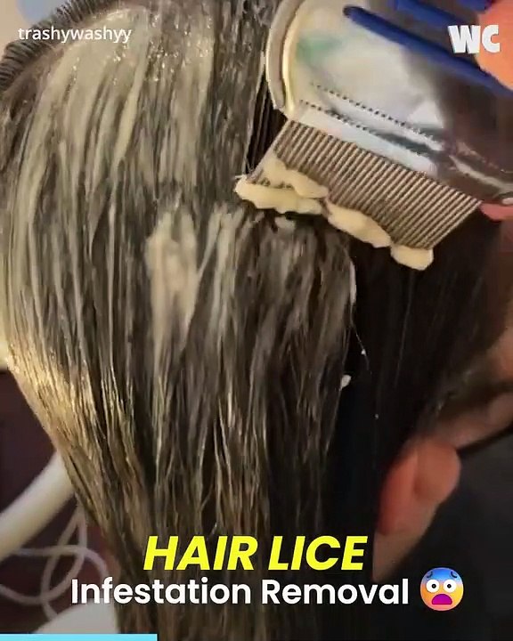 Hair Lice Infestation Removal