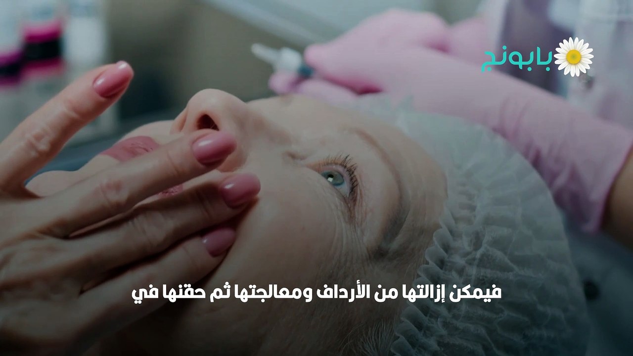الفيلر الطبيعي