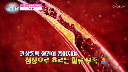 여러 질병을 유발하고 악화시키는 ‘비만’ TV CHOSUN 221018 방송