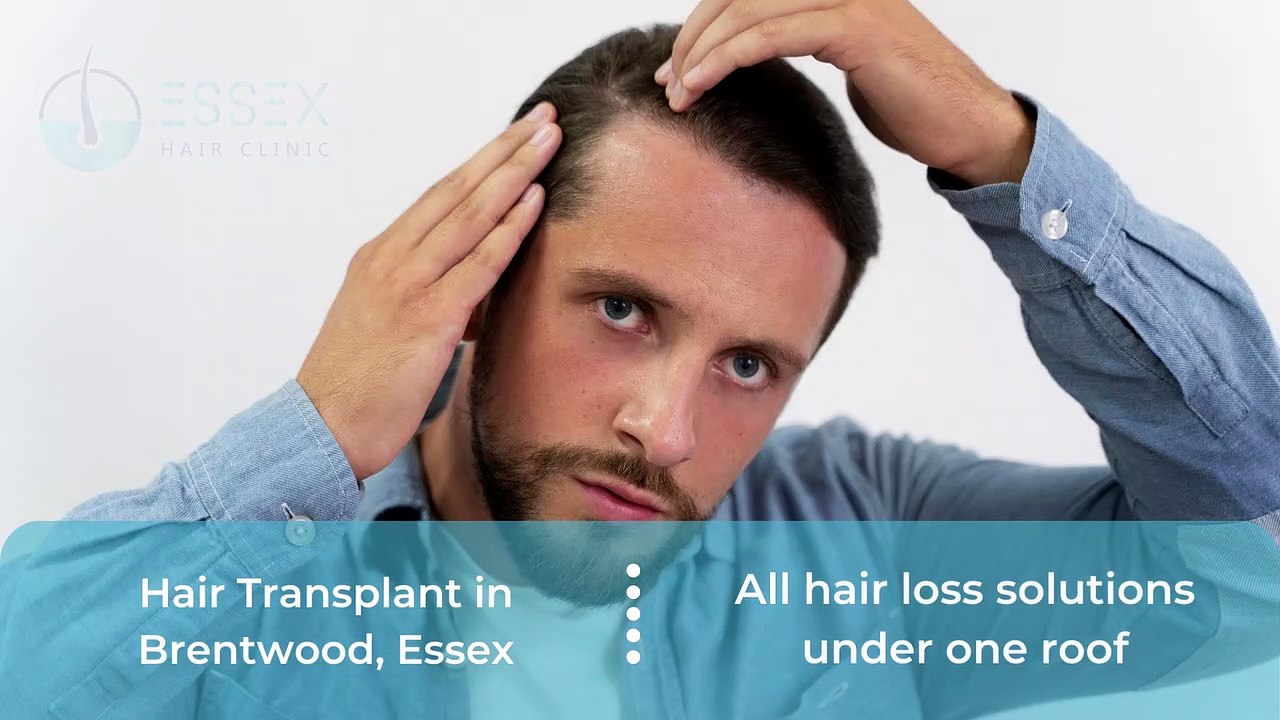 Hair Transplant in Essex video Dailymotion