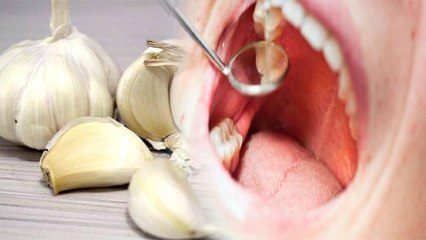 अकल की दर्द में लहसुन से मिलेगा तुरंत आराम, क्या है लगाने का सही तरीका | Boldksy