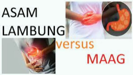 Inilah perbedaa dari penyakit  Maag Vs GERD