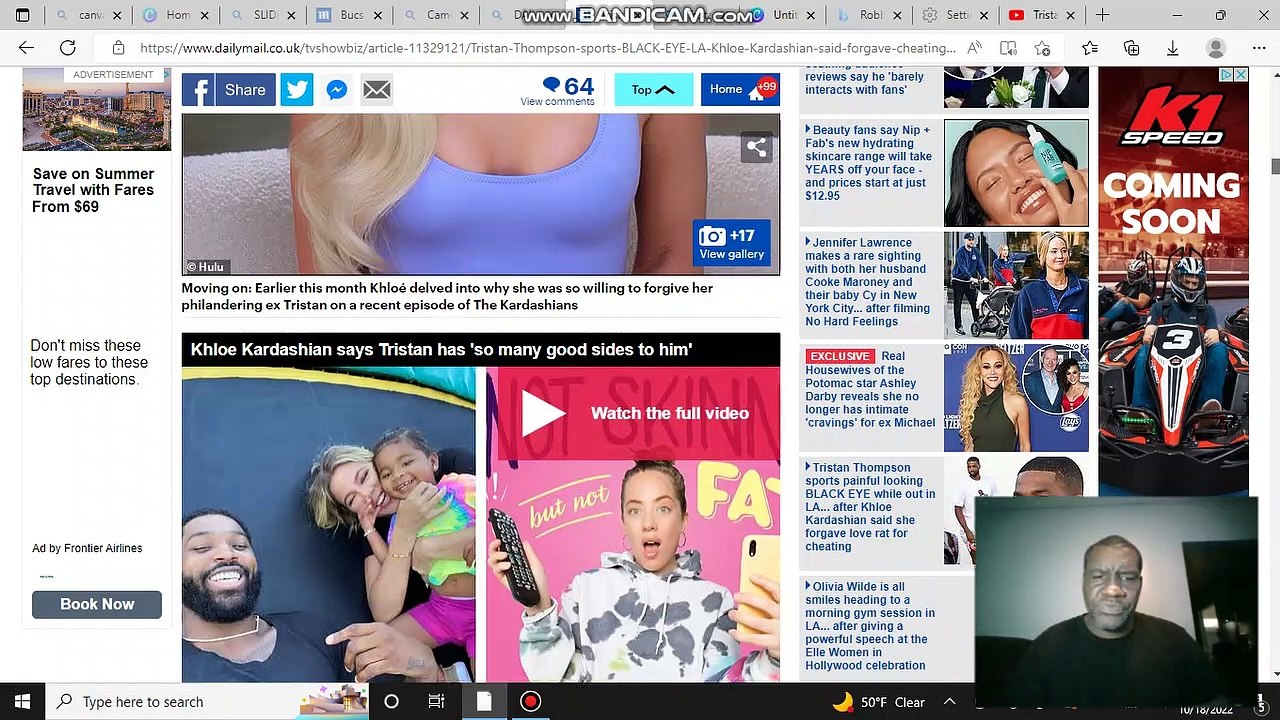 Tristan Thompson sports painful looking BLACK EYE while out in LA... after Khloe Kardashian said she forgave love rat for cheating