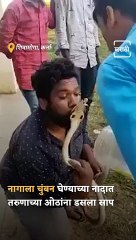 Man Tries To Kiss King Cobra, Gets Bitten On Lips