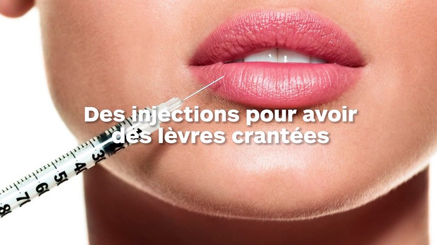 La tendance des injections pour avoir des lèvres crantées en zig zag -  Vidéo Dailymotion