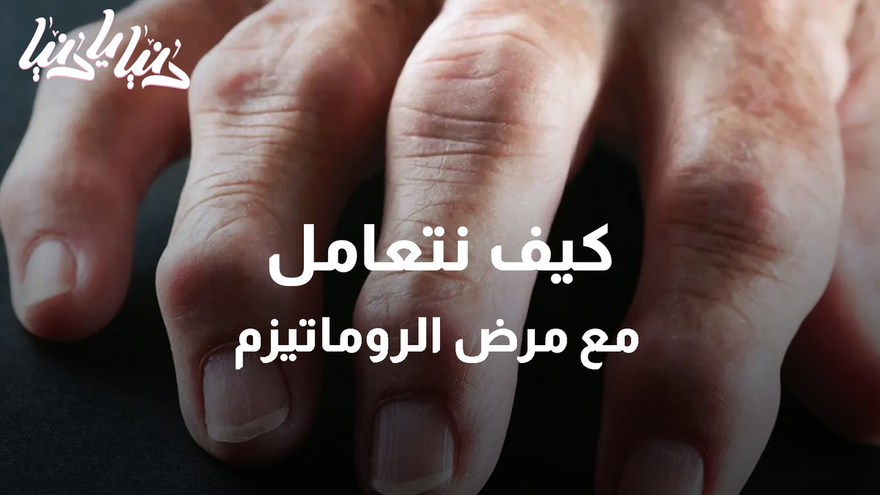 مرض الروماتيزم المرض الأكثر انتشارًا في العالم