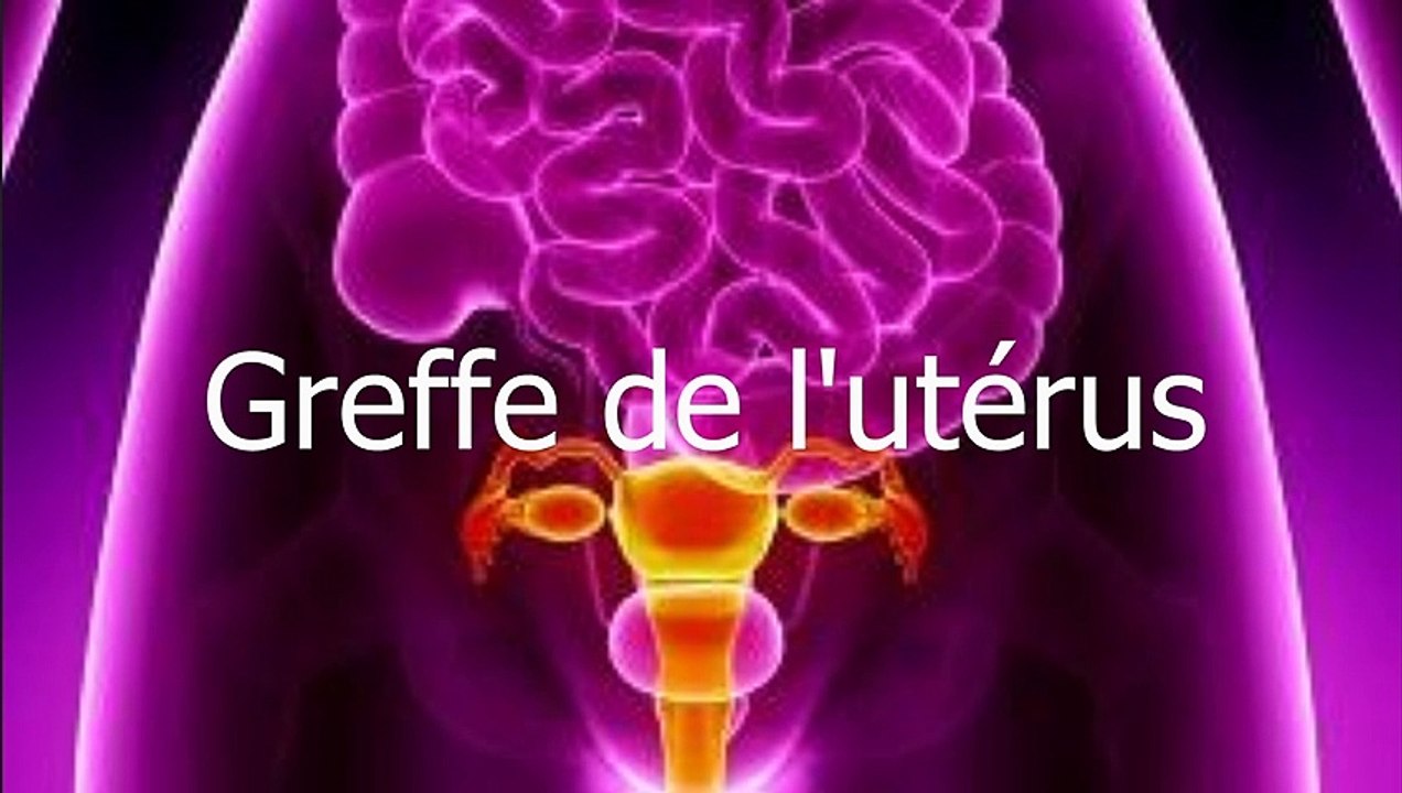 Greffe de l'utérus