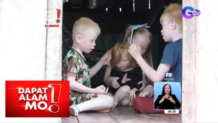Magkakapatid na may kondisyong ‘albinism’, paano nakuha ang pambihirang kondisyon? | Dapat Alam Mo!