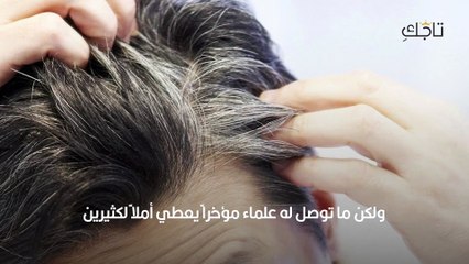 دراسة الإجازة تعيد لون الشعر الأصلي بعد الشيب