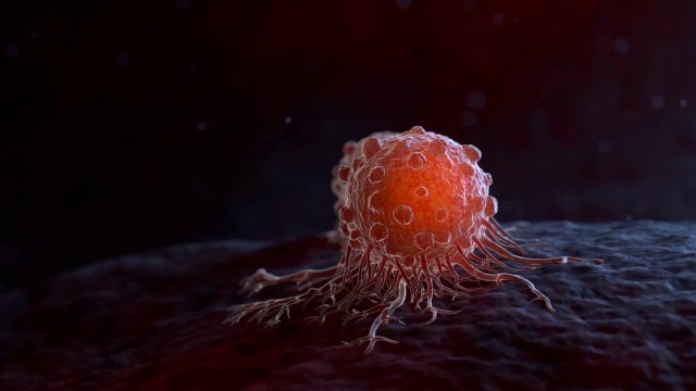 Oncologia, due nuove indicazioni per cemiplimab