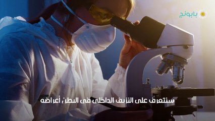 النزيف الداخلي في البطن أعراضه وأسبابه وعلاجه