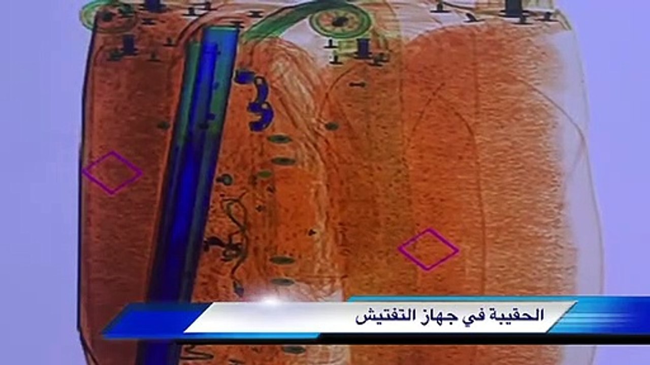 X-ray scanner detects a mass of abnormal density