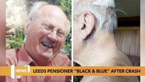 Leeds Headlines October 21: Devastated family tell of heartbreak as Leeds pensioner left 'black and blue' after Morley crash
