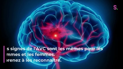 AVC : les 4 signes d'alerte