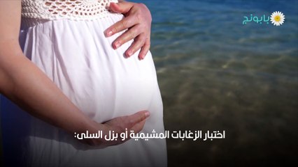 الجنين ولد او بنت