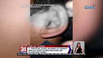 11-anyos na lalaki, nilagnat at sumakit ang ulo dahil sa mga nakitang uod sa kanyang tainga | 24 Oras Weekend