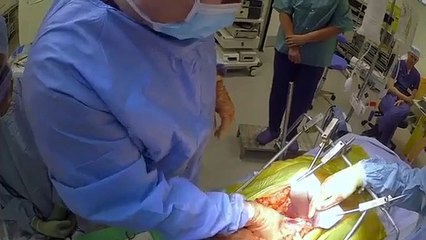 Surgeons - At the Edge of Life - Se2 - Ep05 - Getting Better HD Watch HD Deutsch