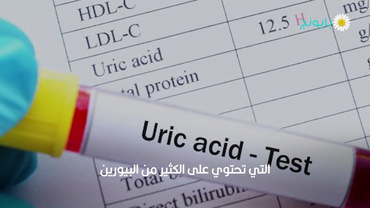 كيفية إزالة اليوريك أسيد من الجسم وتقليل نسبته للحد الأدنى (1) - فيديو ...