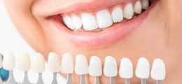 Vos dents sont jaunes ou tachées, voici 2 astuces maison pour les rendre bien blanches