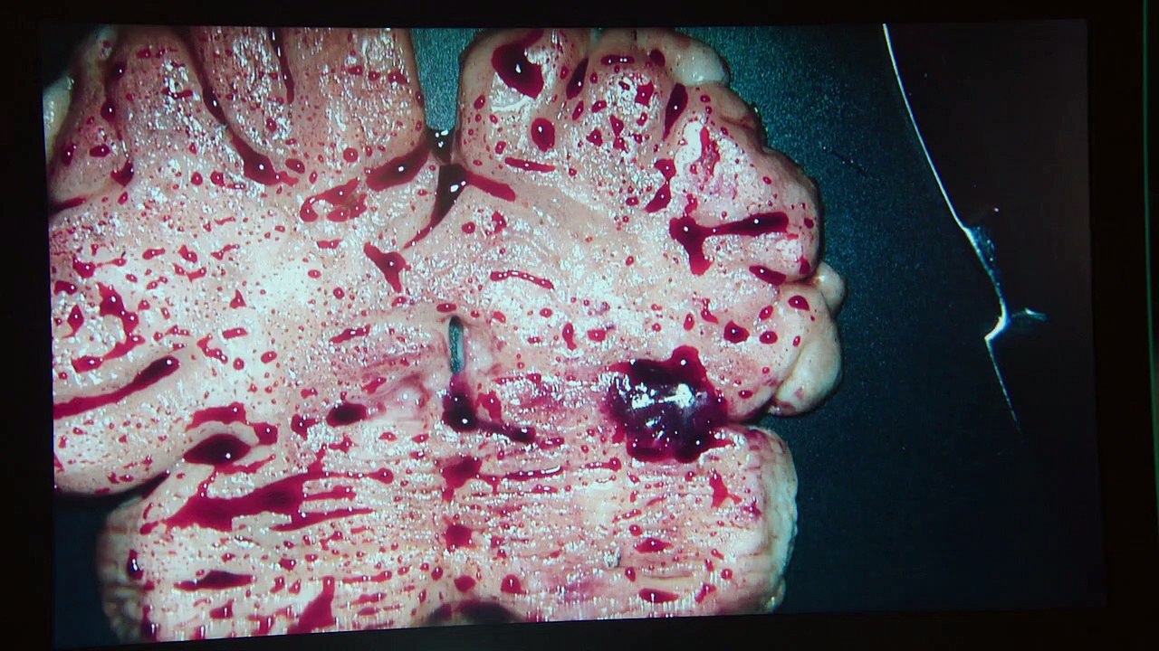 Harrow Staffel 2 Folge 7 HD Deutsch