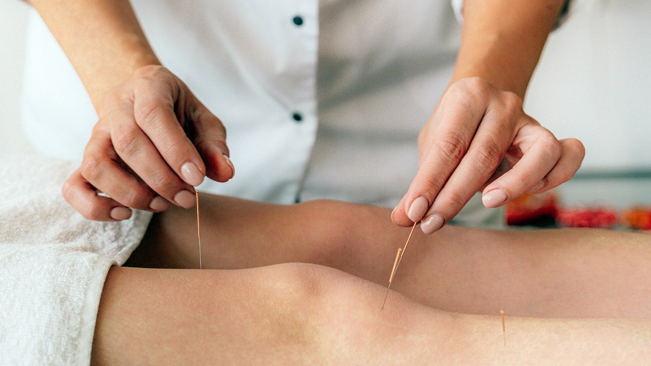 Akupunktur Tekniklerini Öğrenin - Akupunktur APK