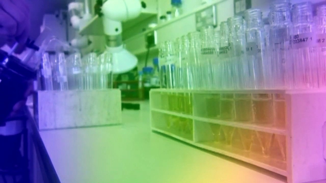 The Curious Life and Death Of... - Se1 - Ep02 - A Rolling Stone HD Watch HD Deutsch