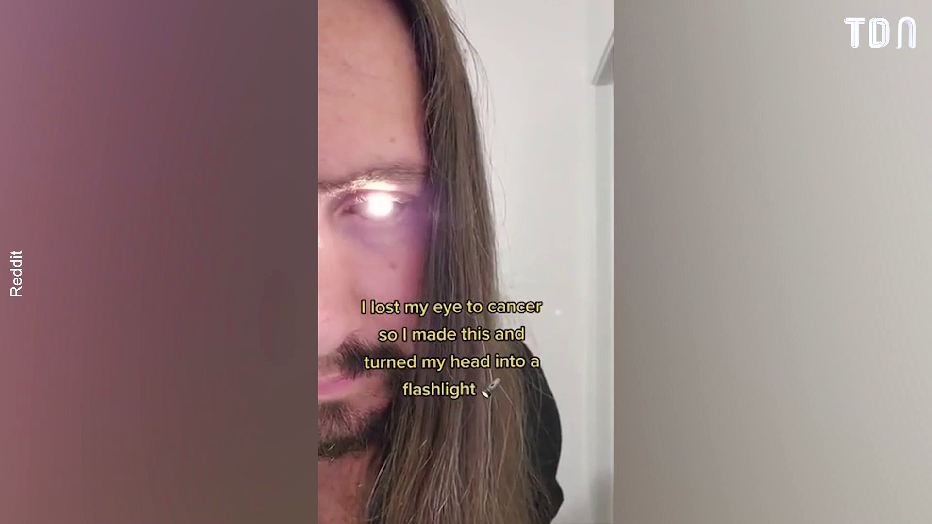 Un homme transforme son œil en lampe de poche après l'avoir perdu à cause  d'un cancer - Vidéo Dailymotion