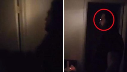 Kanser nedeniyle kaybettiği gözünün yerine taktığı şey görenleri şaşırtıyor