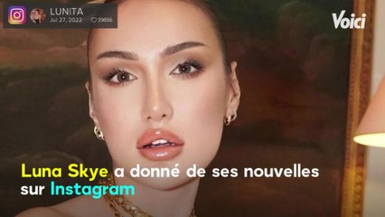 Voici - Luna Skye une nouvelle fois opérée en toute discrétion, elle donne de ses nouvelles