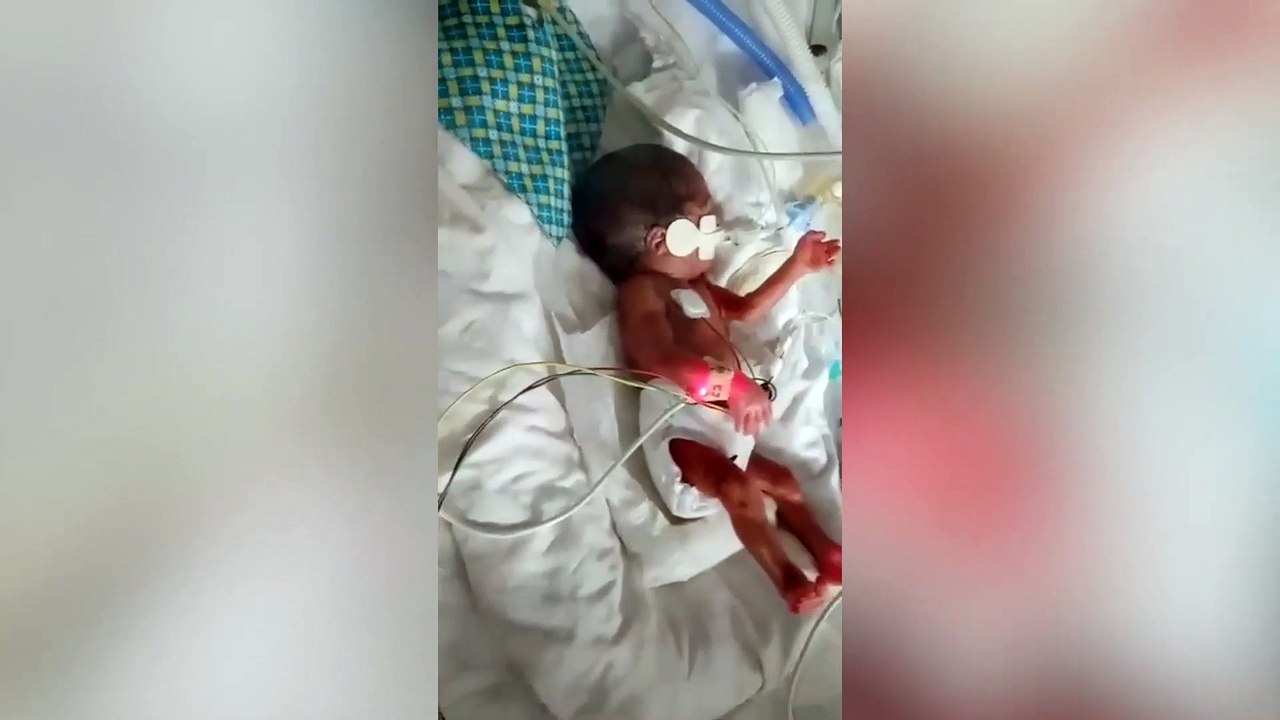 A premature baby whose heart stopped beating for 17 minutes has beaten the odds to come home - after more than three months in hospital