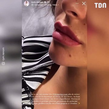 Une influenceuse partage une nouvelle fois sa séance d'injections