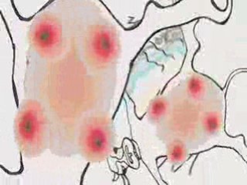 GENETIC DANCE (Extrait)