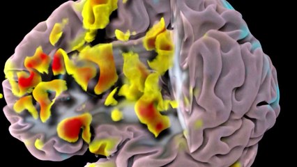 Ciência já consegue "ler mentes"? Algoritmo é capaz de escanear pensamentos