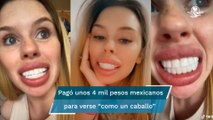 Mujer se somete a un “diseño de sonrisa” y sale mal