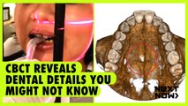CBCT reveals dental details you might not know | Next Now