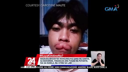 #KuyaKimAnoNa?: Magkakaibigan na mangunguha sana ng santol sa Bukidnon, tinamaan ang pugad ng putakte; isa sa kanila, na-sting sa labi | 24 Oras