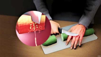 ما هو الألم، ولماذا نشعر به؟