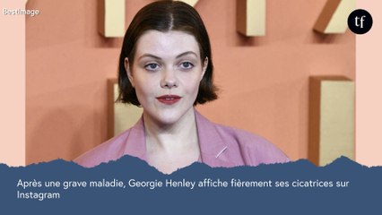 Après une grave maladie, l'actrice de "Narnia" Georgie Henley dévoile ses cicatrices