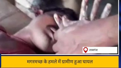 गोंडा: मगरमच्छ के हमले में ग्रामीण हुआ घायल, वन विभाग की टीम ने किया रेस्क्यू