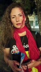 Jornalista com adesivo do Lula é espancada em Curitiba