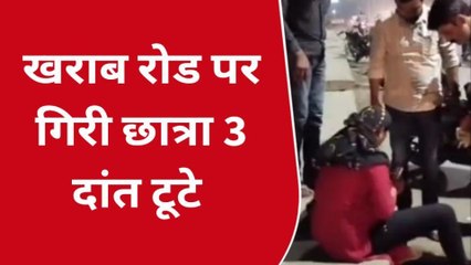 सागर: स्मार्ट रोड ने छीनी युवती की स्मार्टनेस, स्कूटी से गिरने से टूटे दांत
