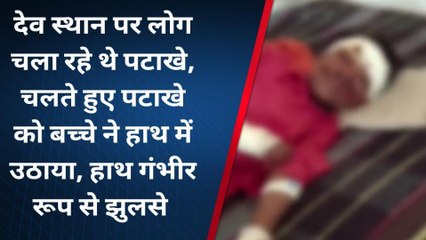अशोकनगर : जलते हुए पटाखे को मासूम ने हाथ में उठाया, गंभीर रूप से झुलसा