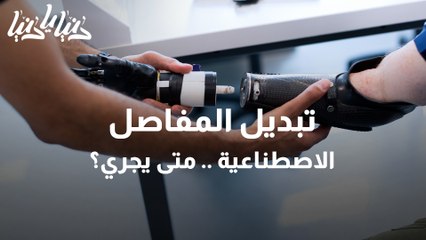 تبديل المفاصل الاصطناعية
