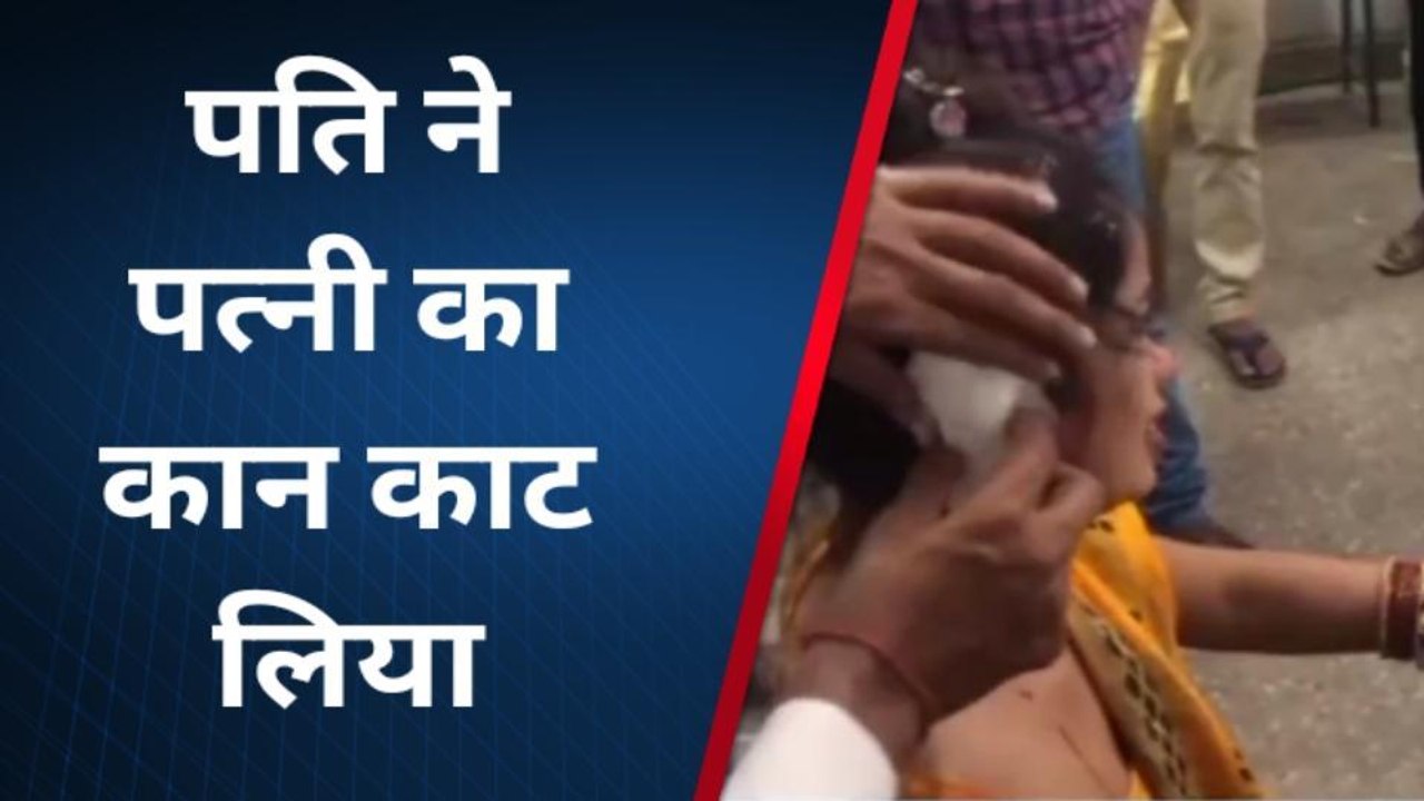 उन्नाव:मायके से ससुराल आई पत्नी से मारपीट कर पति ने काटा कान, साथ ही ससुर का काटा हाथ, घायल बाप-बेटी सीएचसी में भर्ती