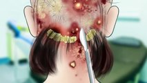 ASMR animation_Treat the girl's scalp to help her treat scabies and remove lice-